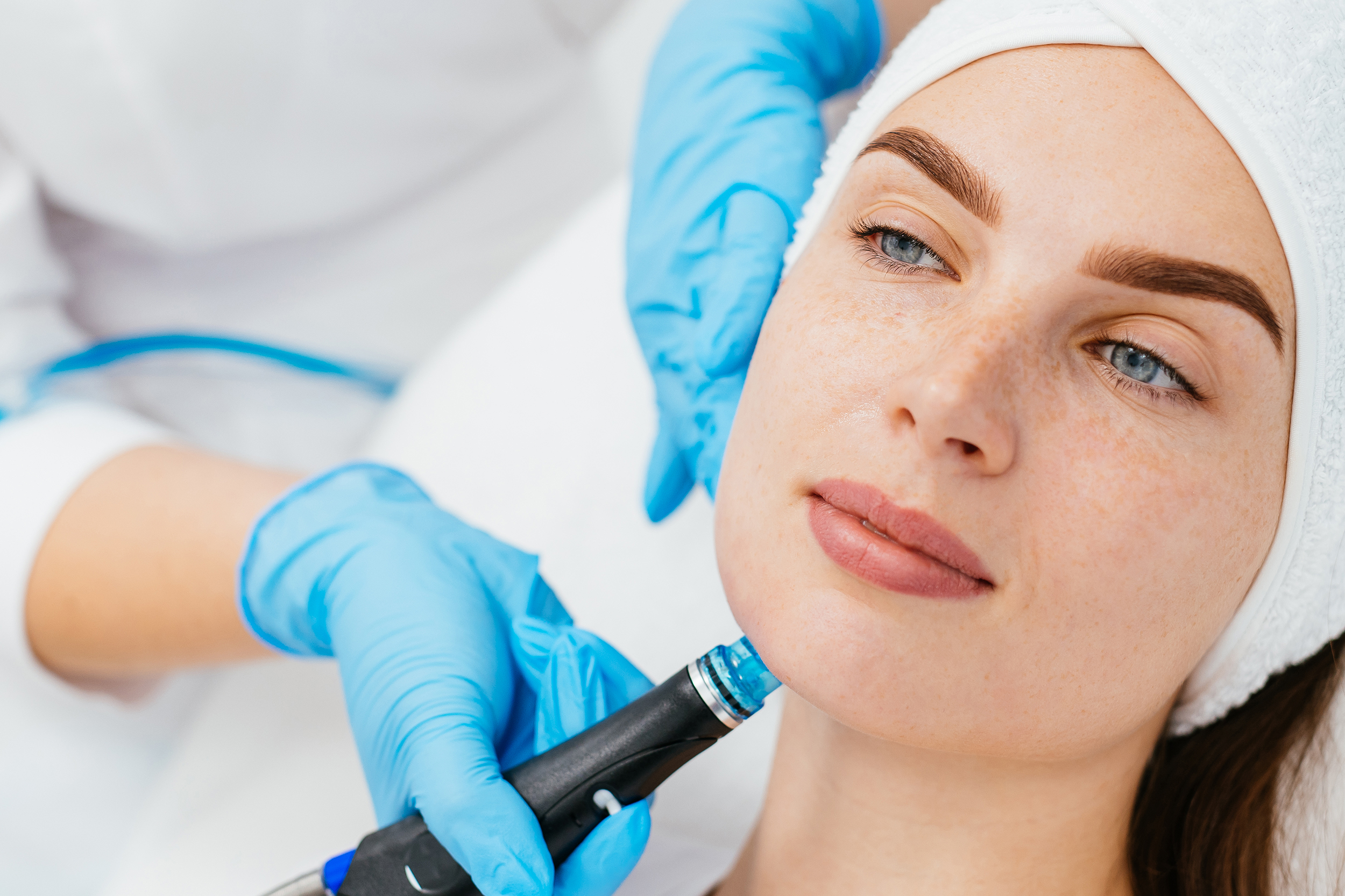 The Benefits of Hydradermabrasion: Revitalize Your Skin with Advanced Treatment